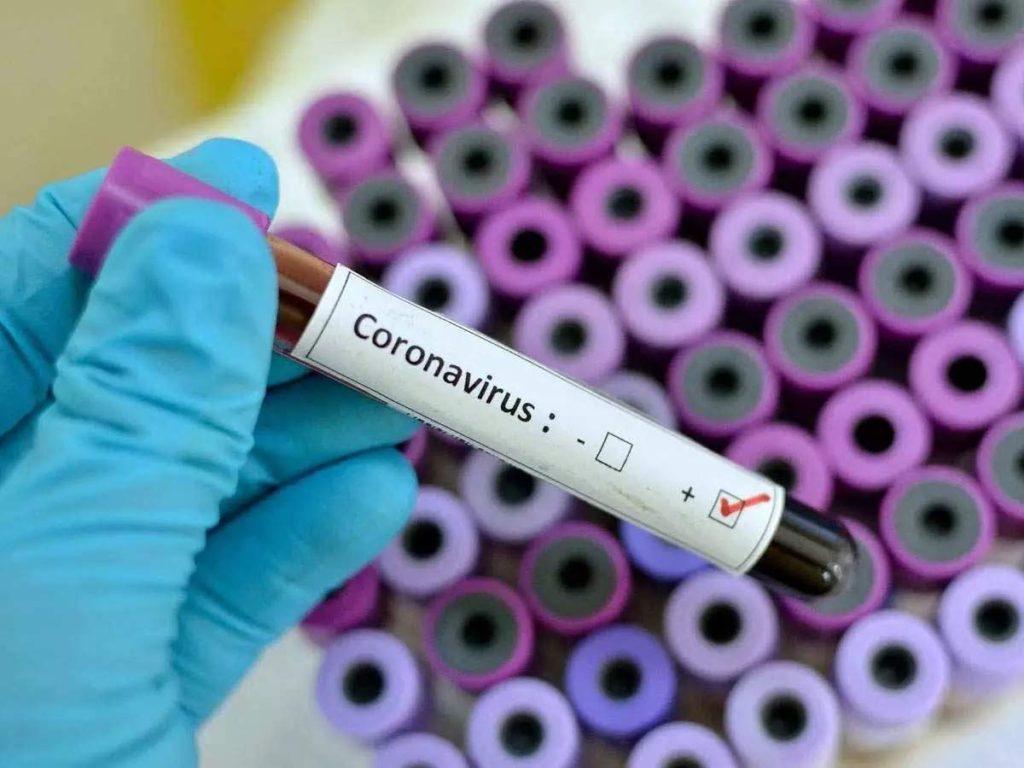 coronavirus treatment in kukatpally 1024x768 1